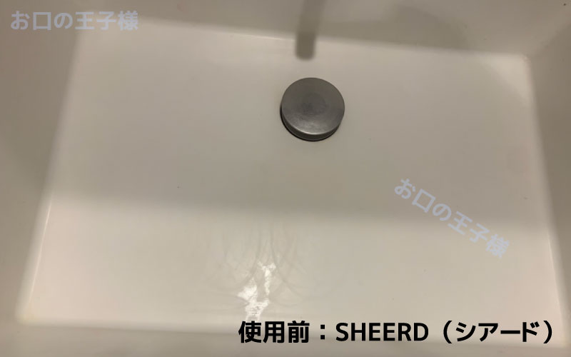 SHEERD（シアード）は実際に口内の汚れが落とせるか検証